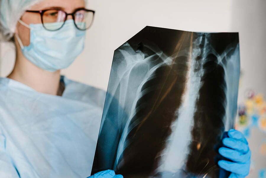 when a pulmonary doctor says he hears dead spaces in lungs, what does it mean when a pulmonary doctor says he hears dead spaces in lungs, what does it mean