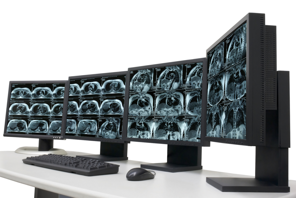 Medical Image Transfer - several monitors with magnetic resonance images