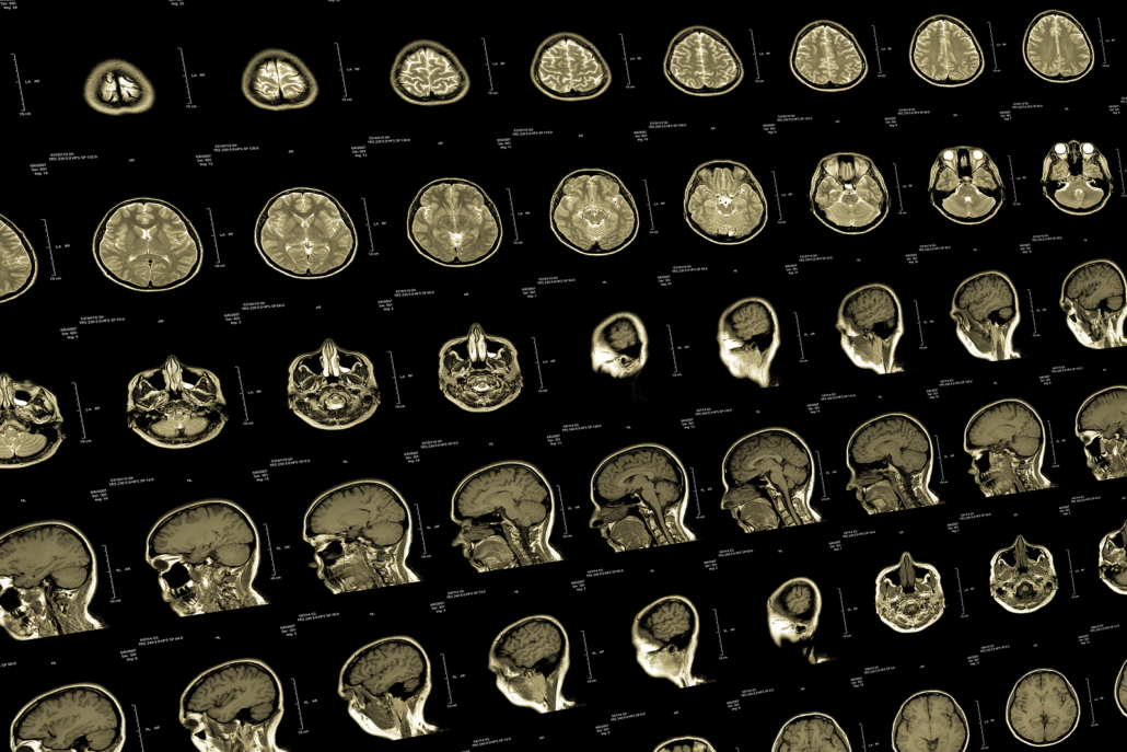 medical imaging - Brain and head MRI or CT images