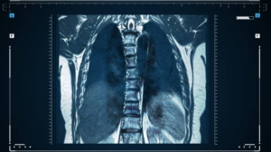 Medical imaging storage - Lungs imaging