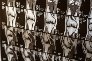 medical imaging - Medical Imaging
