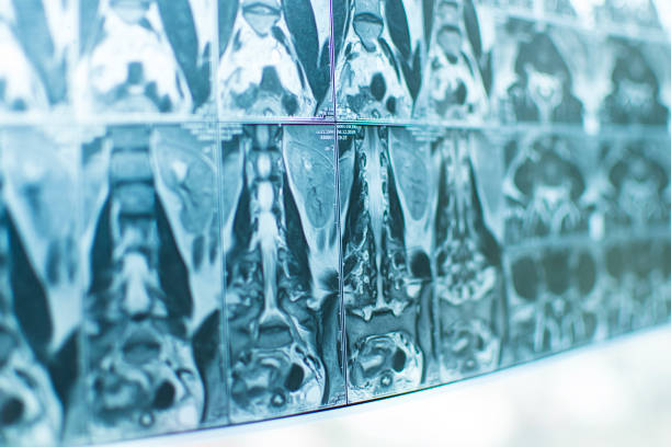 medical imaging - medical image