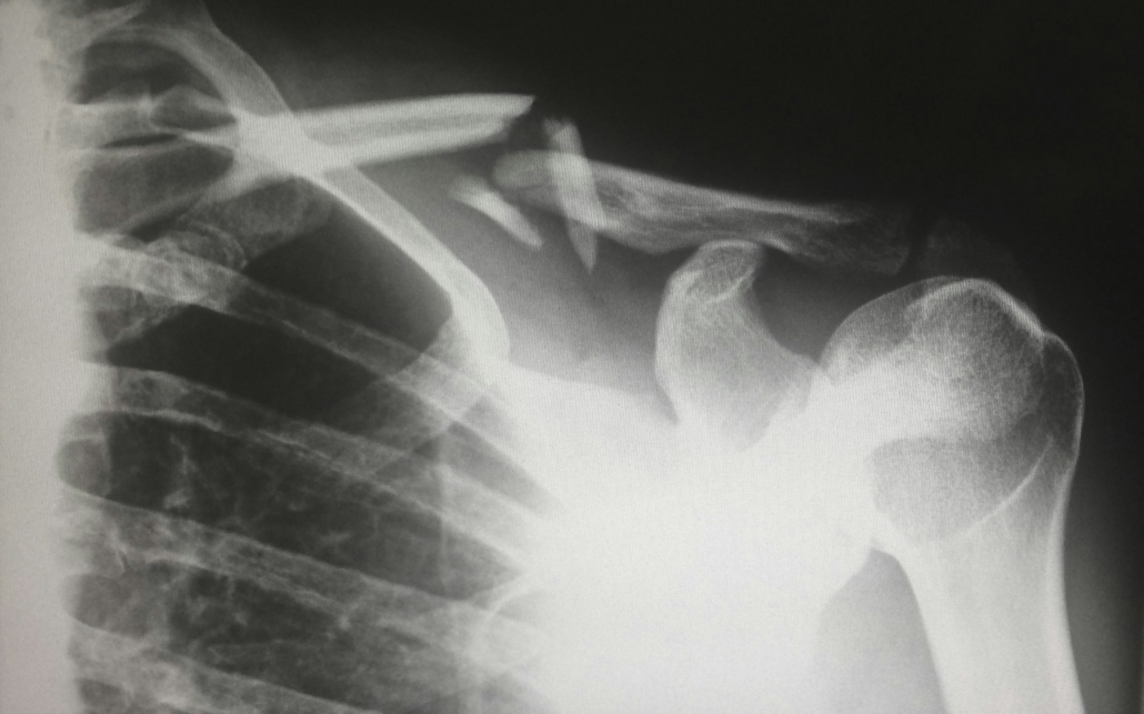 medical imaging - x ray