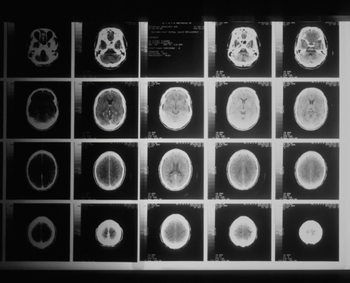 medical imaging systems - medical imaging